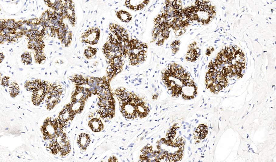 14 - E-Cadherin AD80073