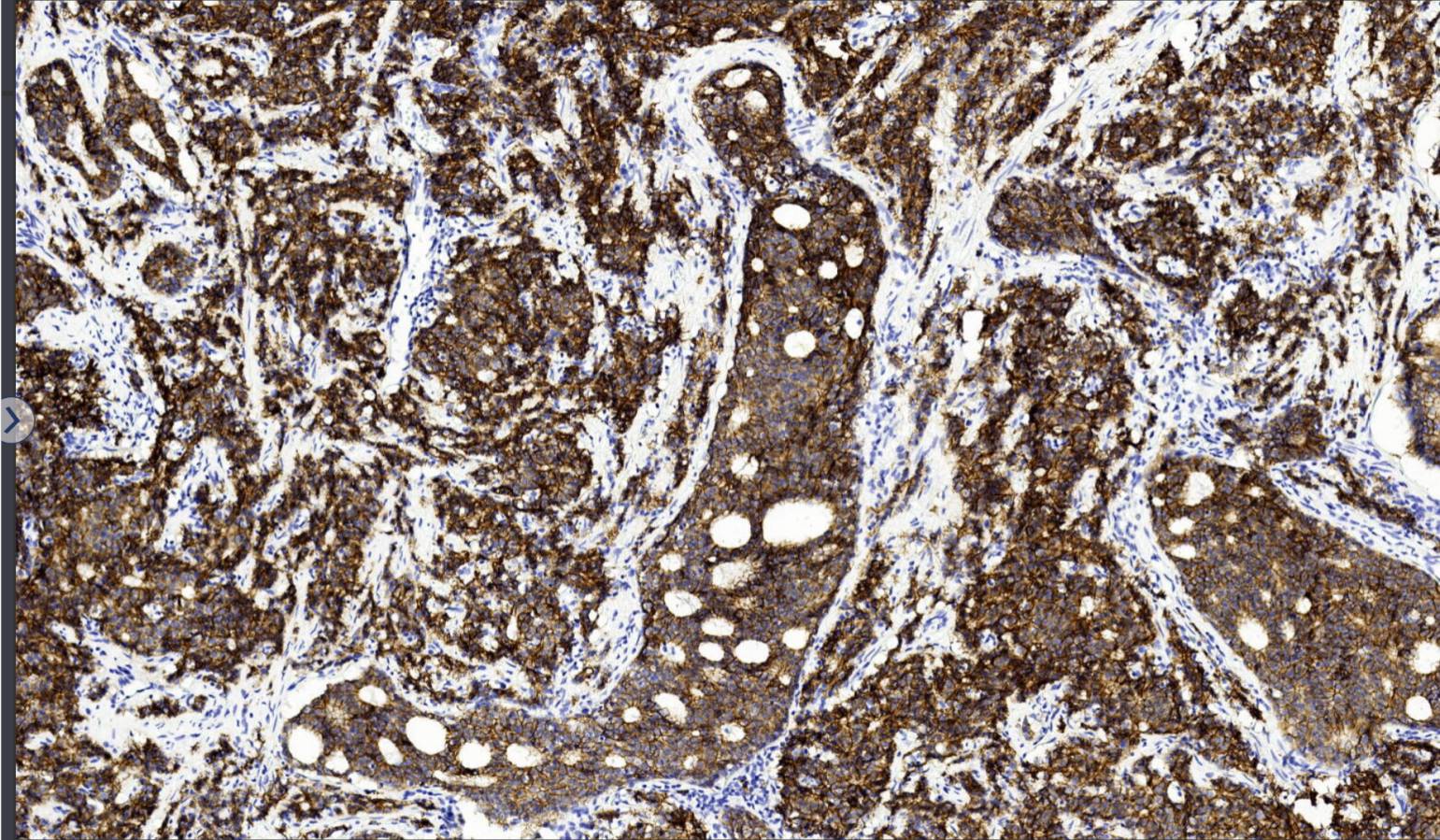 14 - E-Cadherin AD80073