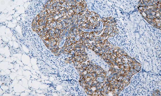 14 - E-Cadherin AD80073
