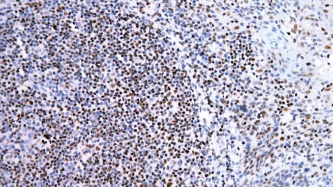14 - FOXP1 AD80076