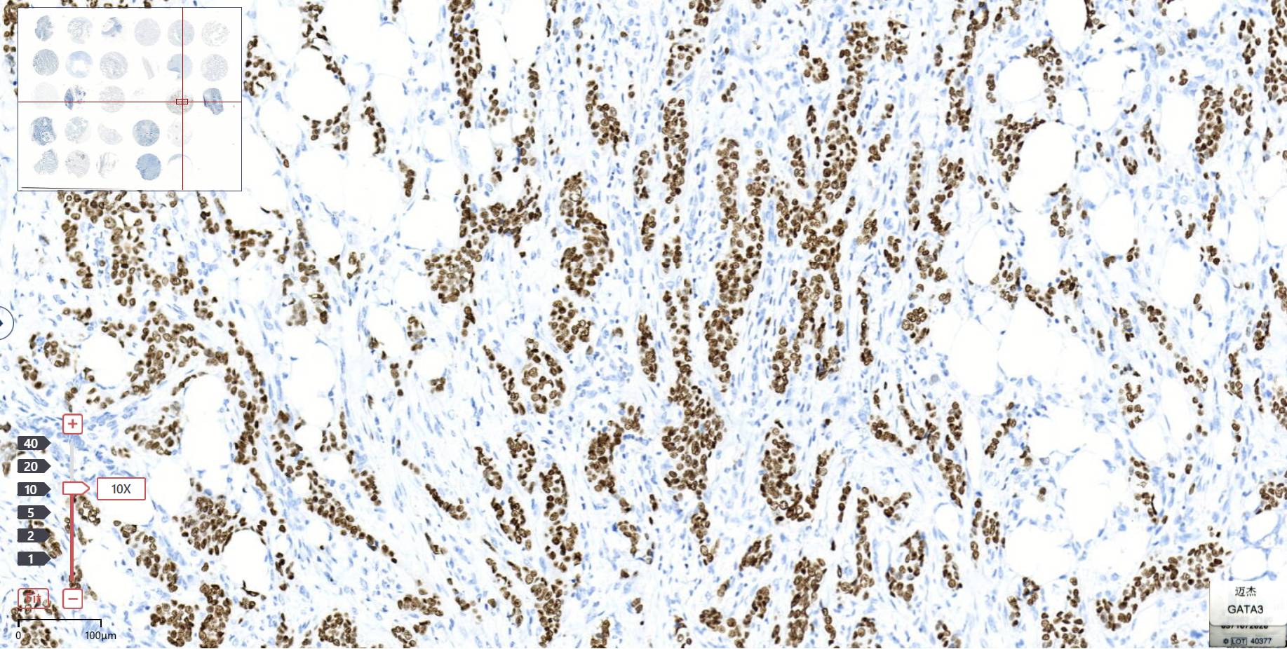14 - Anti-GATA3 antibody AD80077