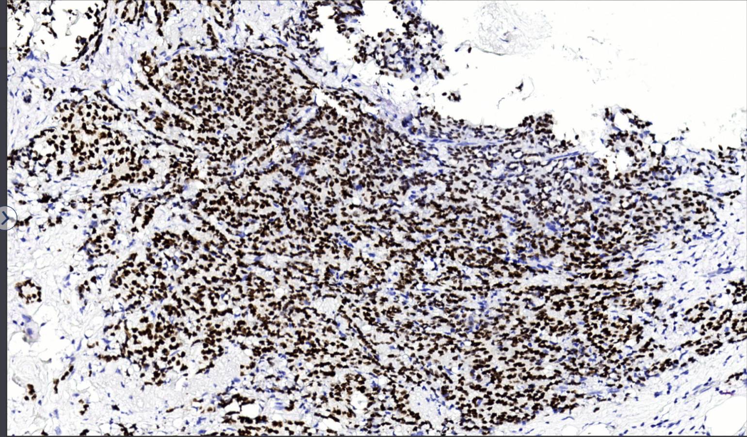 14 - Anti-GATA3 antibody AD80077