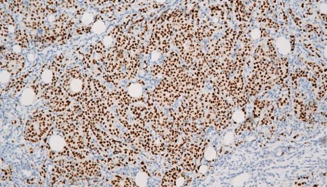 14 - Anti-GATA3 antibody AD80077