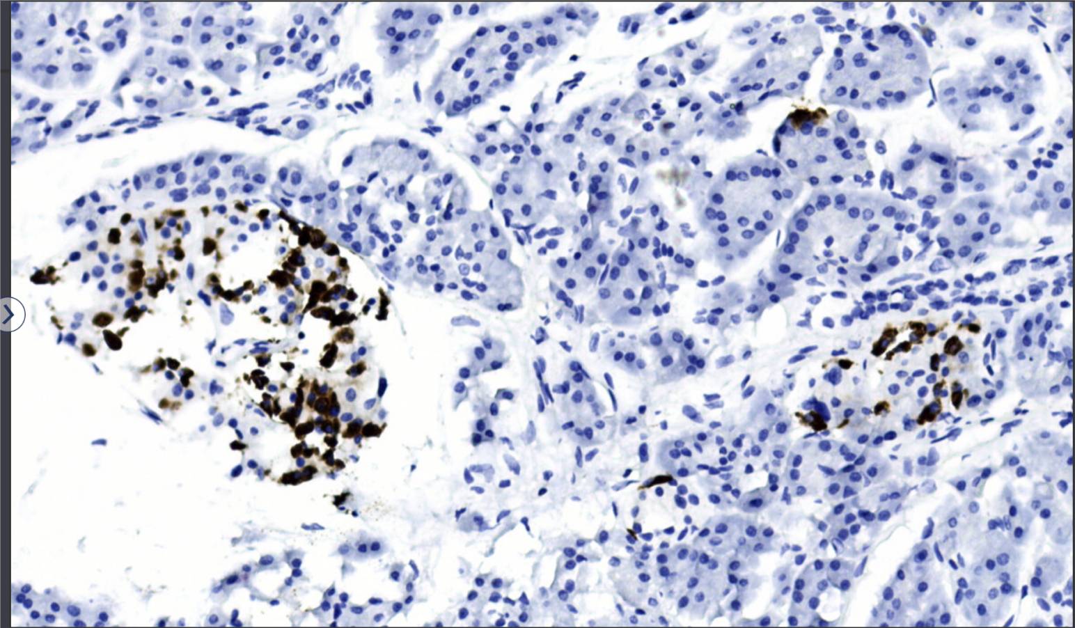 14 - Glucagon AD80078