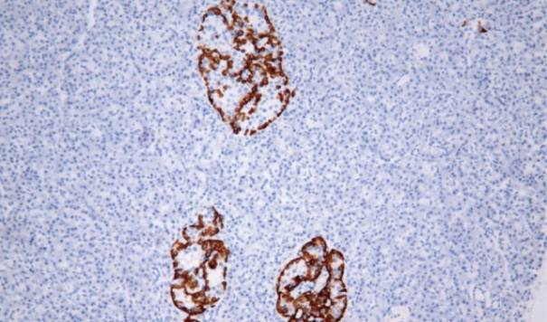 14 - Glucagon AD80078