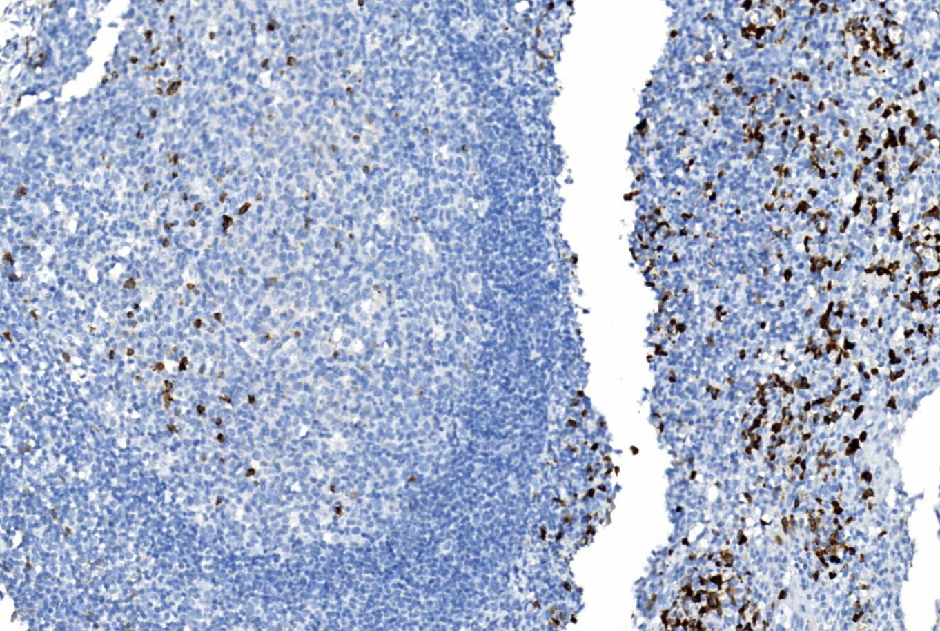 14 - Lambda链 AD80089