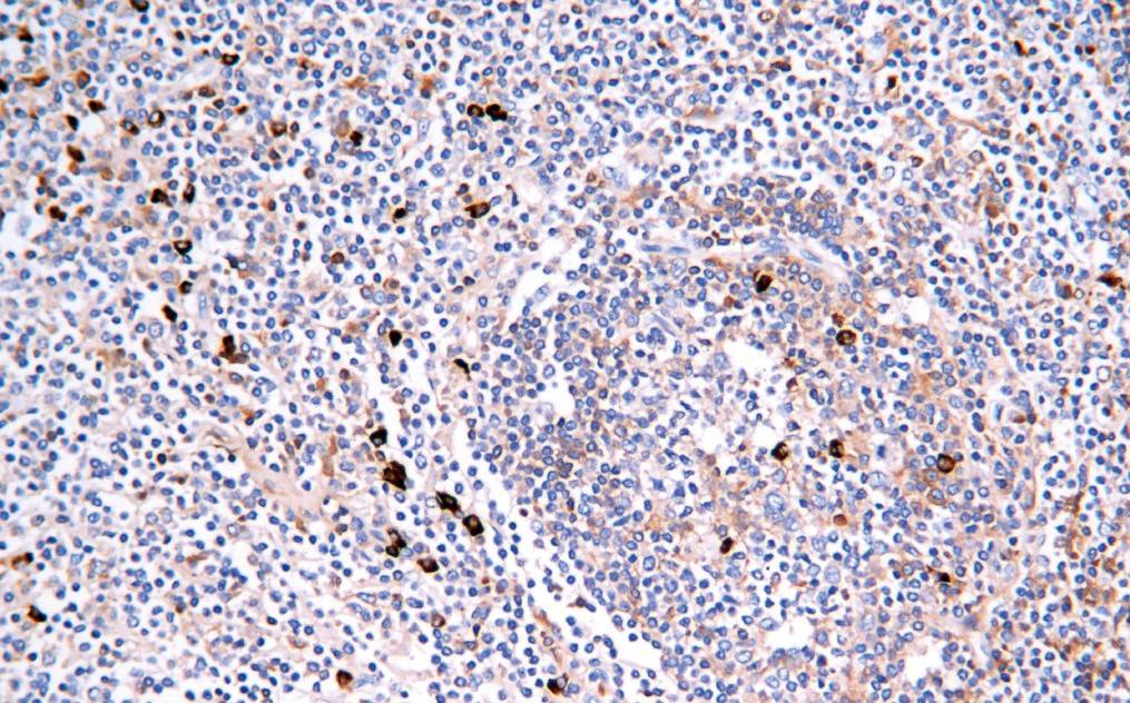 14 - Lambda链 AD80089