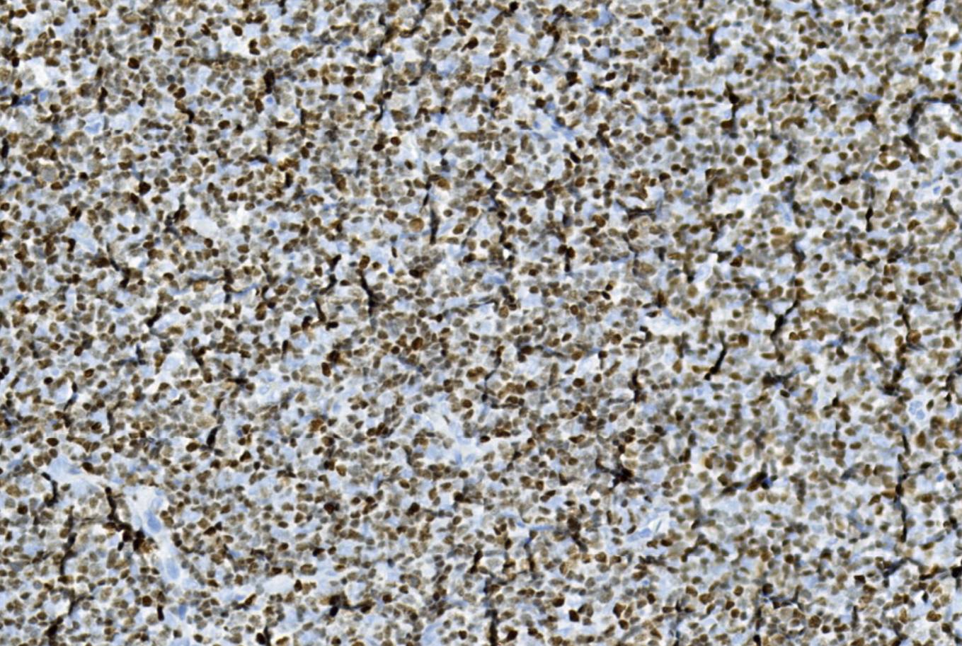 14 - LEF-1 AD80090