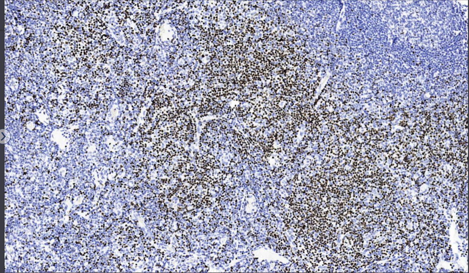 14 - LEF-1 AD80090