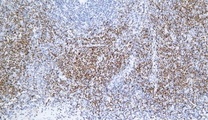 14 - LEF-1 AD80090