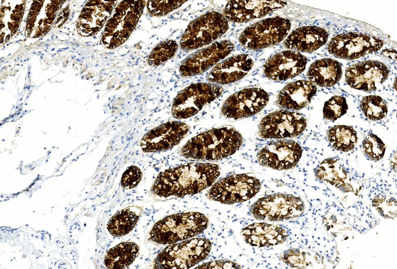 14 - MUC-1 AD80095