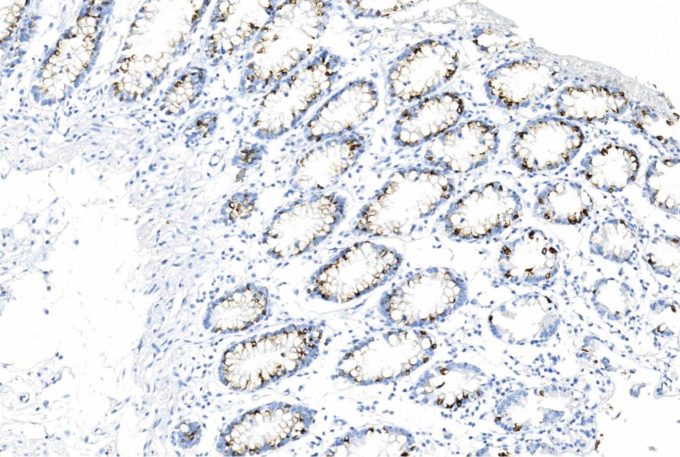 14 - MUC2 AD80096