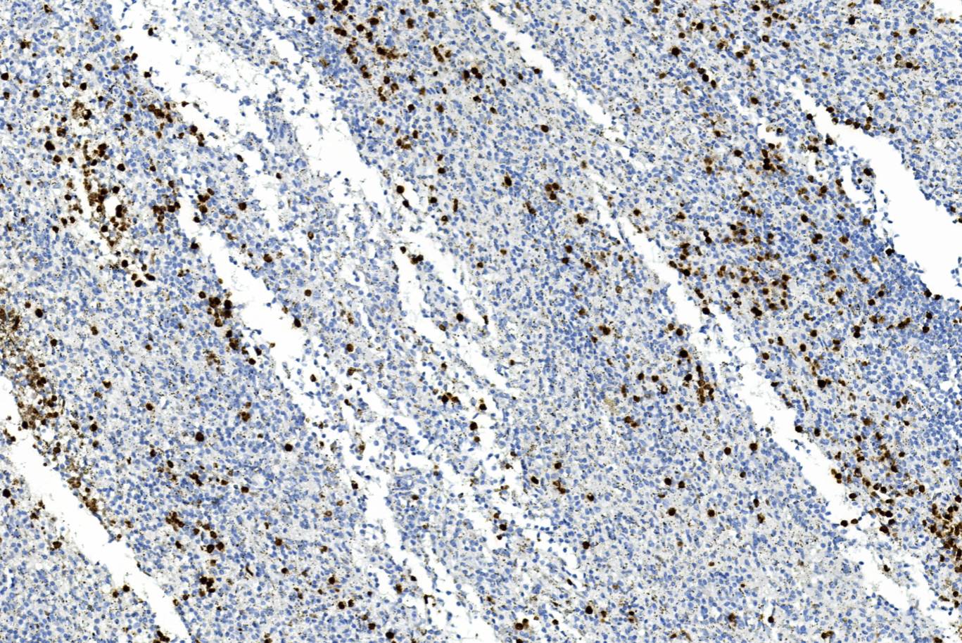 14 - Myeloperoxidase AD80098