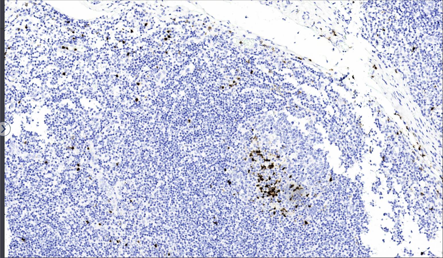 14 - Myeloperoxidase AD80098