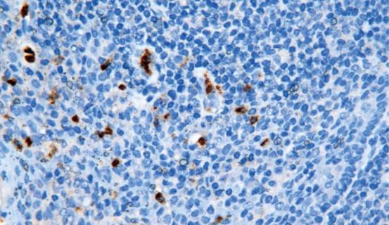 14 - Myeloperoxidase AD80098