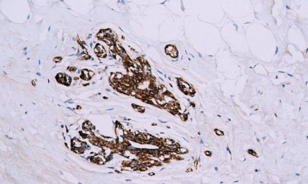 14 - Myosin Light Chain2 AD80100