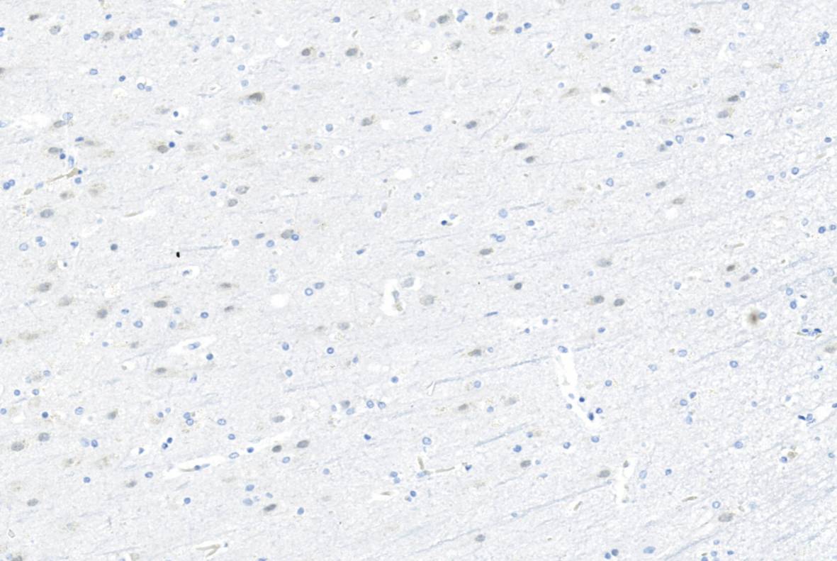 14 - NeuN AD80103