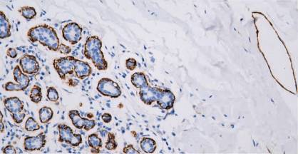 14 - Podoplanin AD80108