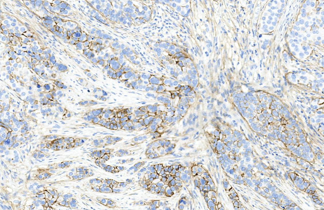 14 - CD138 AD80117