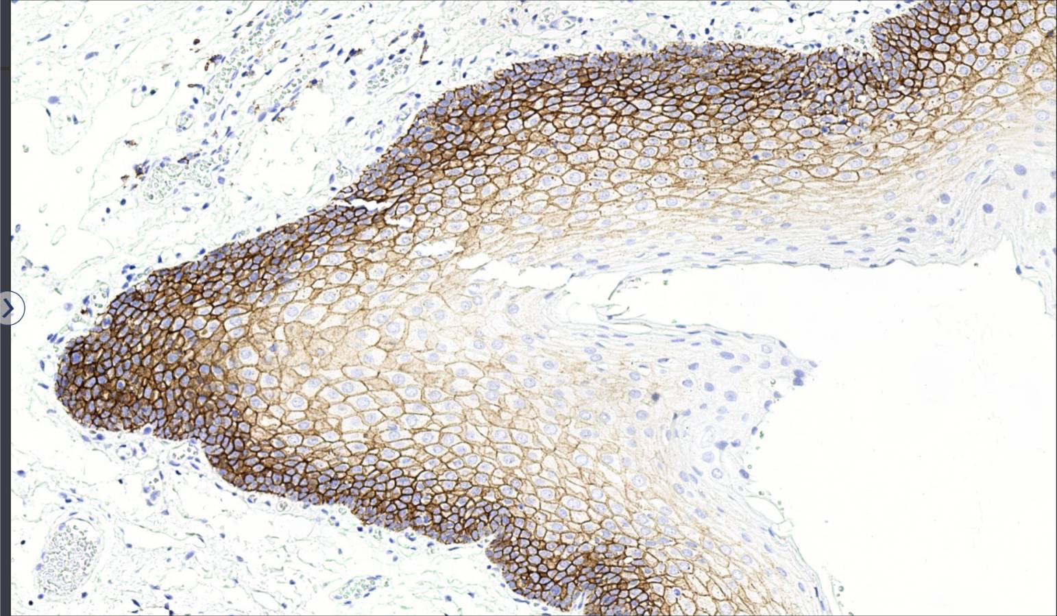 14 - CD138 AD80117