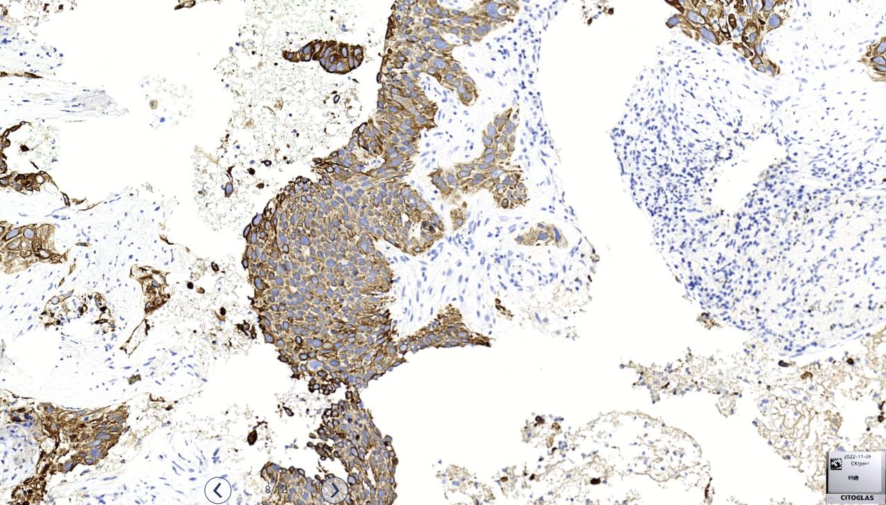 14 - CK（Pan） AD80125