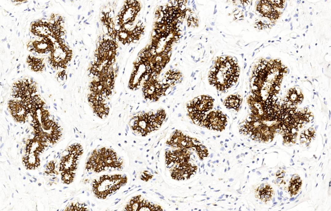 14 - CK（Pan） AD80125