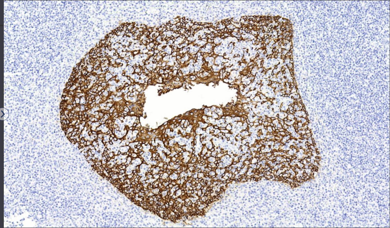 14 - CK34Beta E AD80128