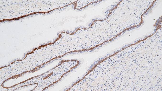 14 - CK34Beta E AD80128