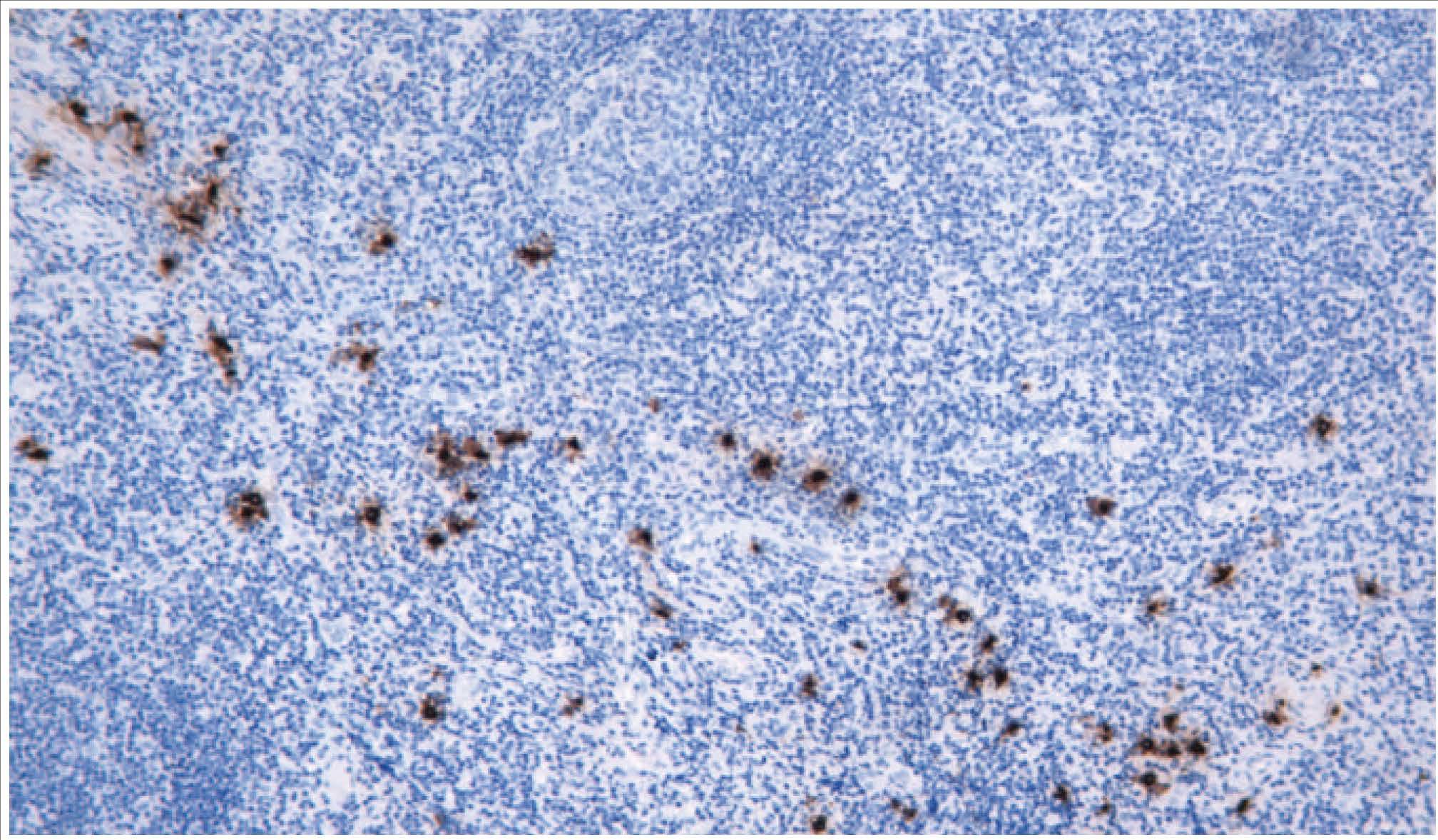 14 - Tryptase AD80134