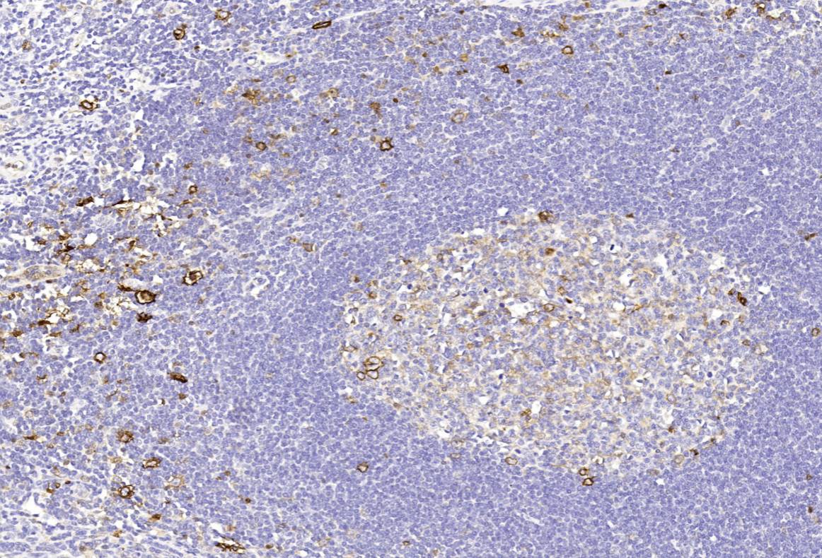 14 - CD30 AD80137