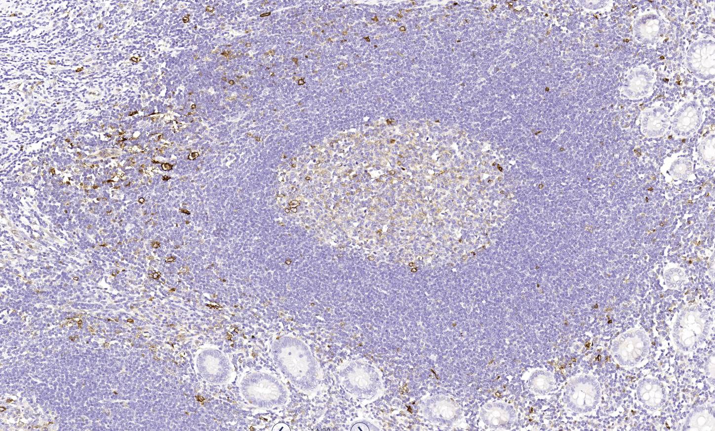 14 - CD30 AD80137