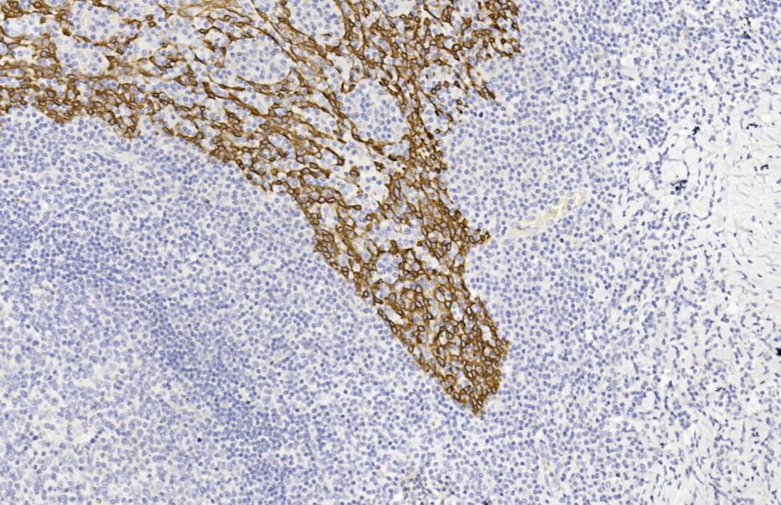 14 - CK14 AD80138