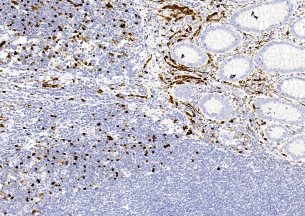 14 - S100 AD80139