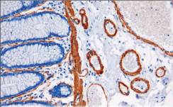 14 - SMA AD80141