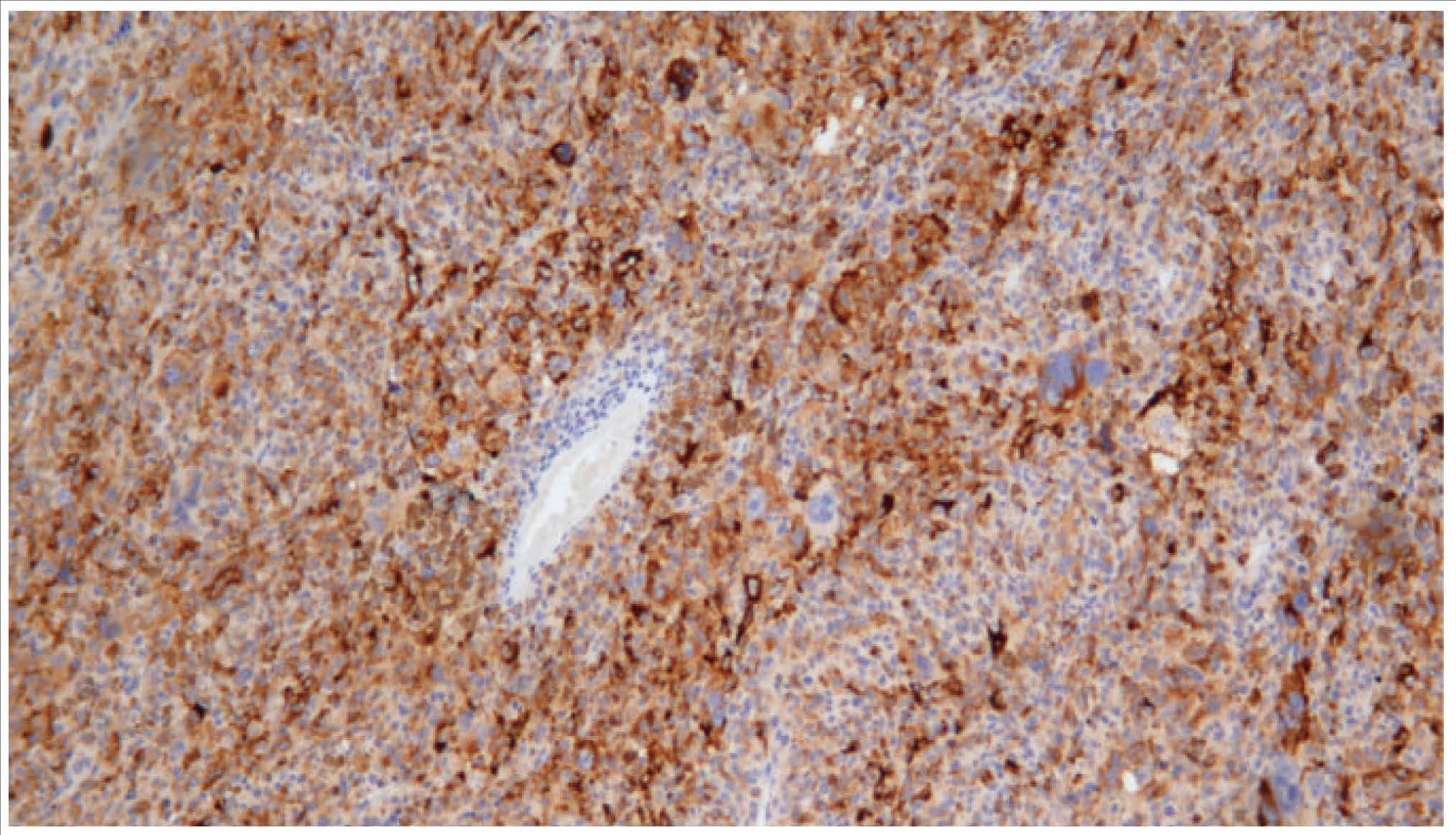 14 - Tyrosinase AD80147