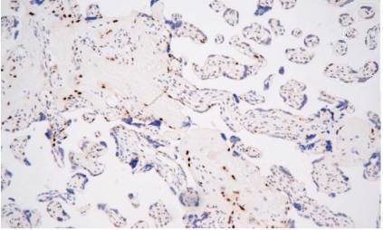 14 - p57 AD80149
