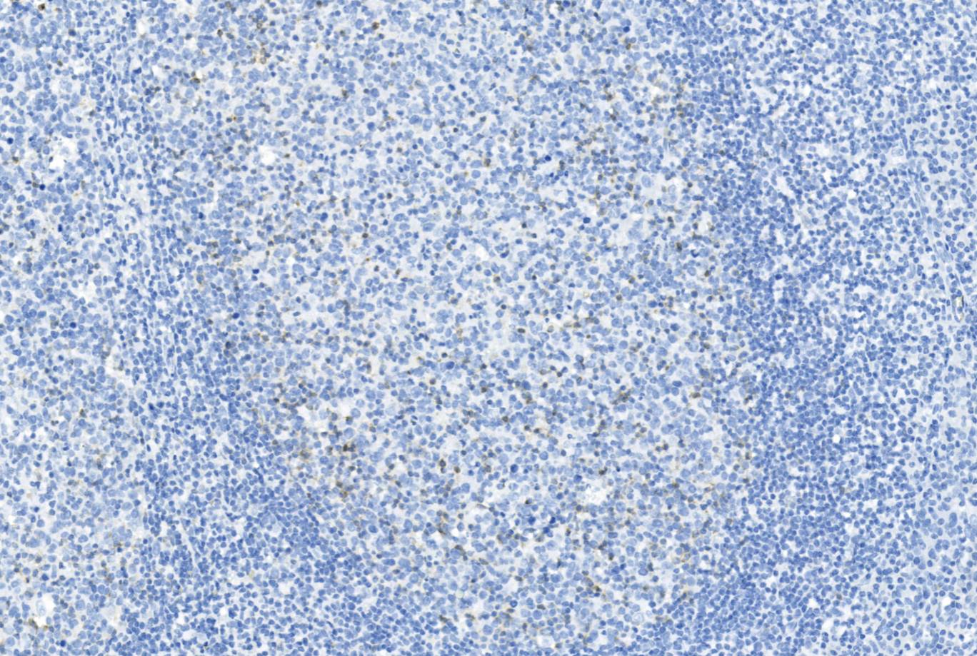 14 - PD-1 AD80153