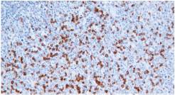 14 - PD-1 AD80153