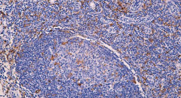 14 - AIF1 AD80154