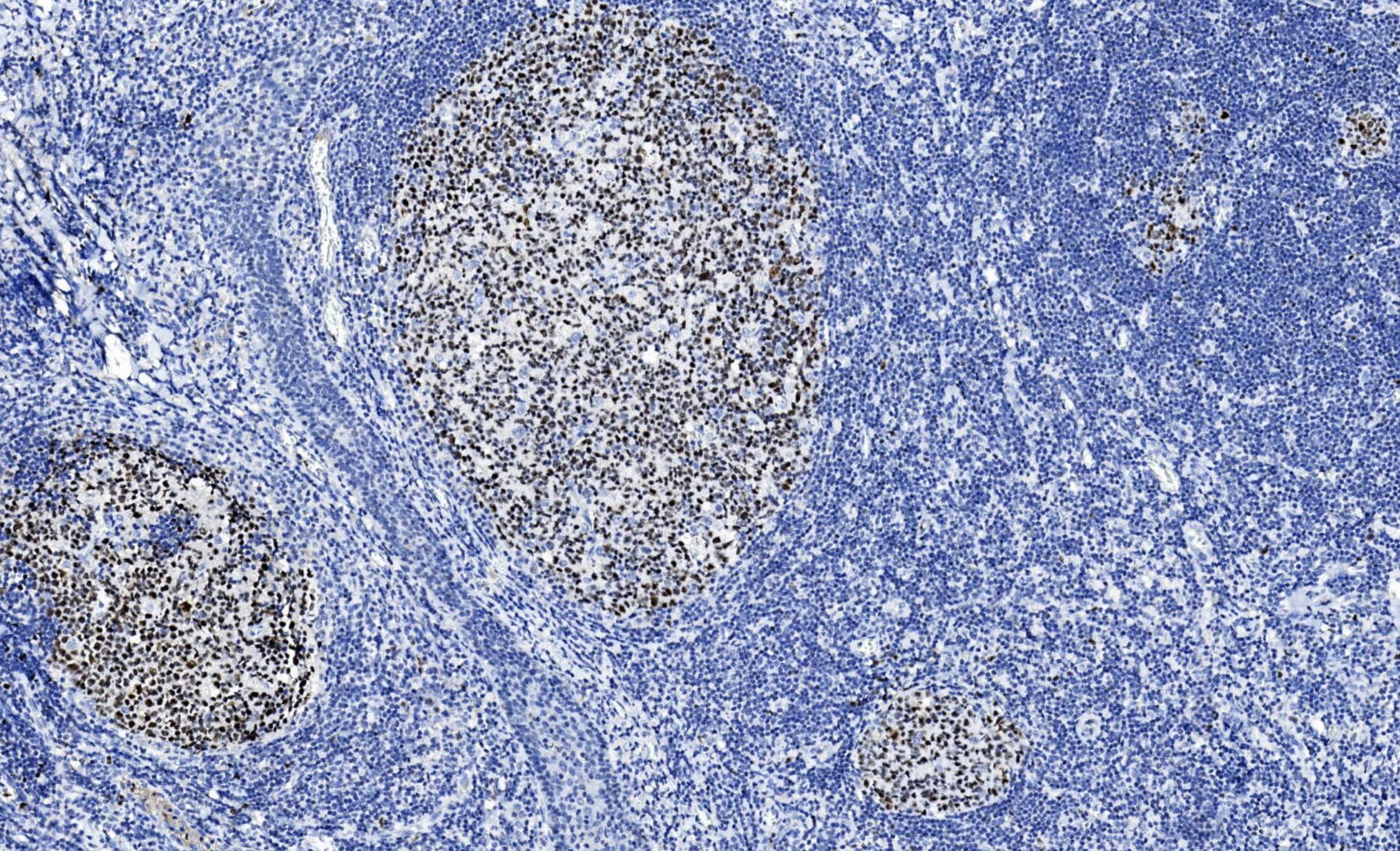 14 - bcl-6 AD80155