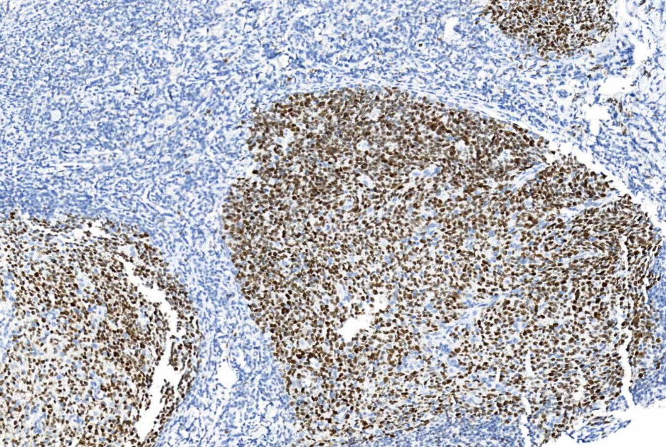 14 - bcl-6 AD80155