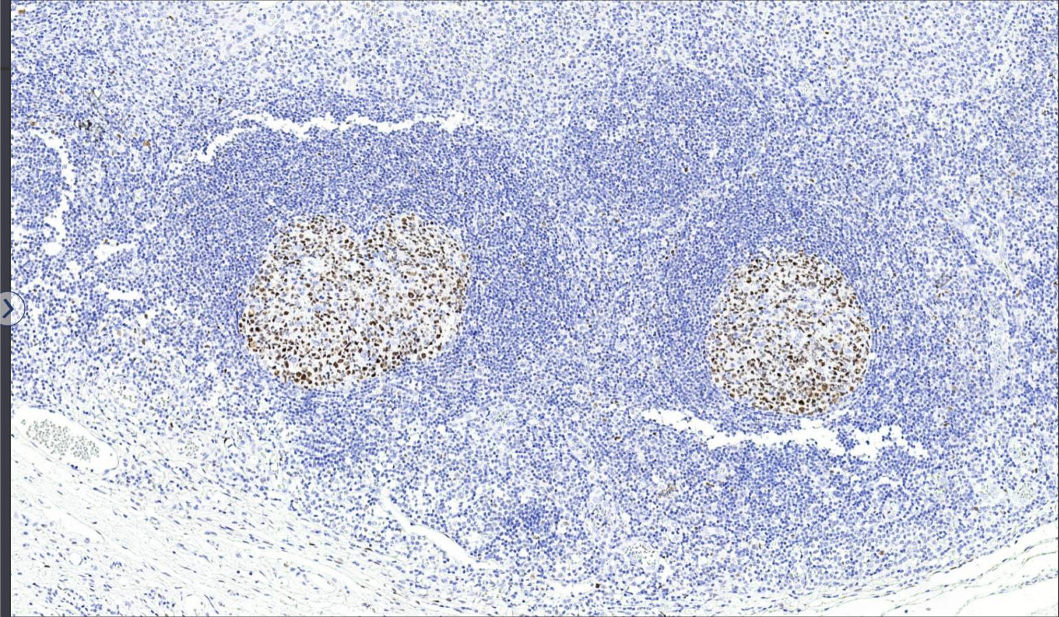 14 - bcl-6 AD80155