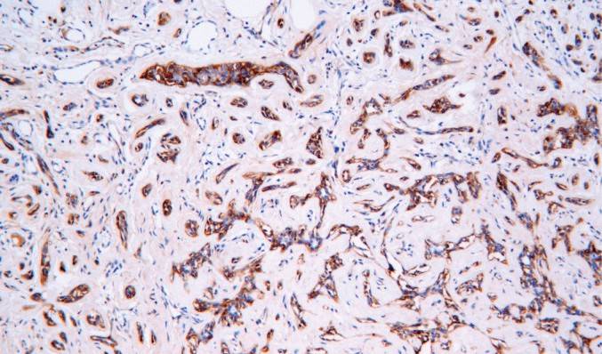 14 - Ferritin HC AD80161
