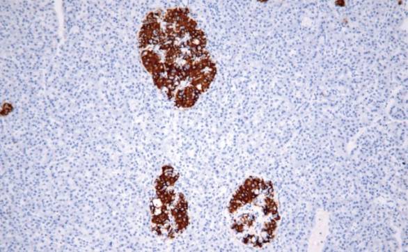 14 - Insulin AD80162