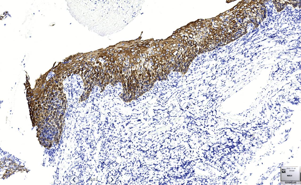 14 - CK5&6 AD80169