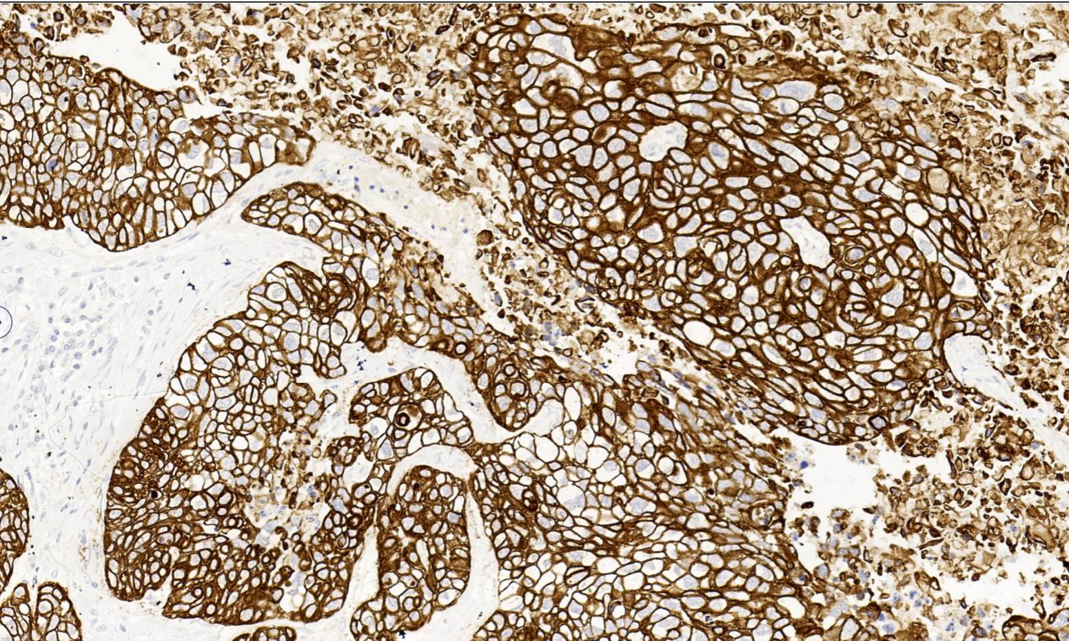 14 - CK5&6 AD80169