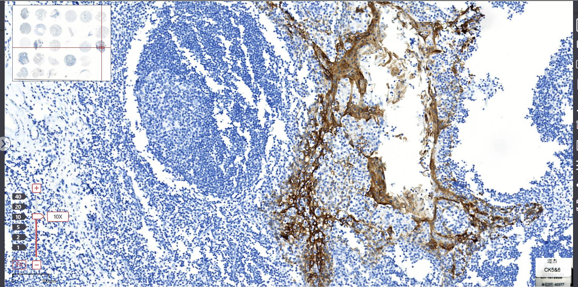 14 - CK5&6 AD80169