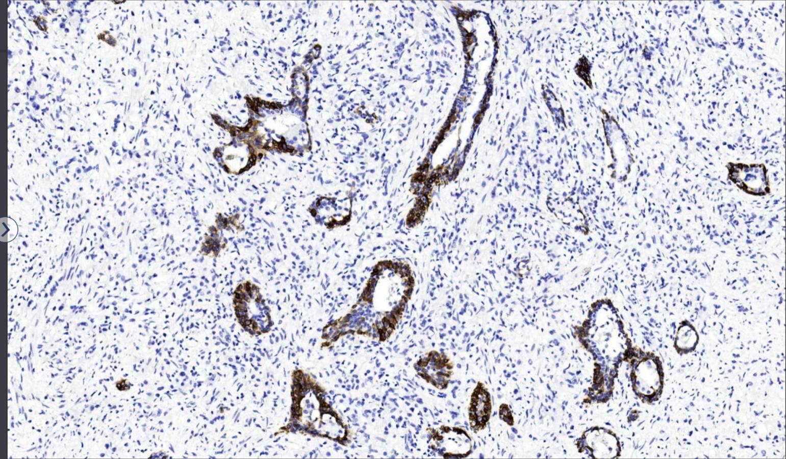 14 - CK5&6 AD80169