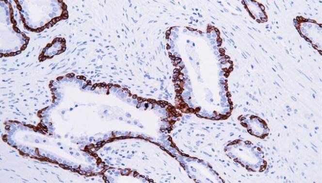14 - CK5&6 AD80169