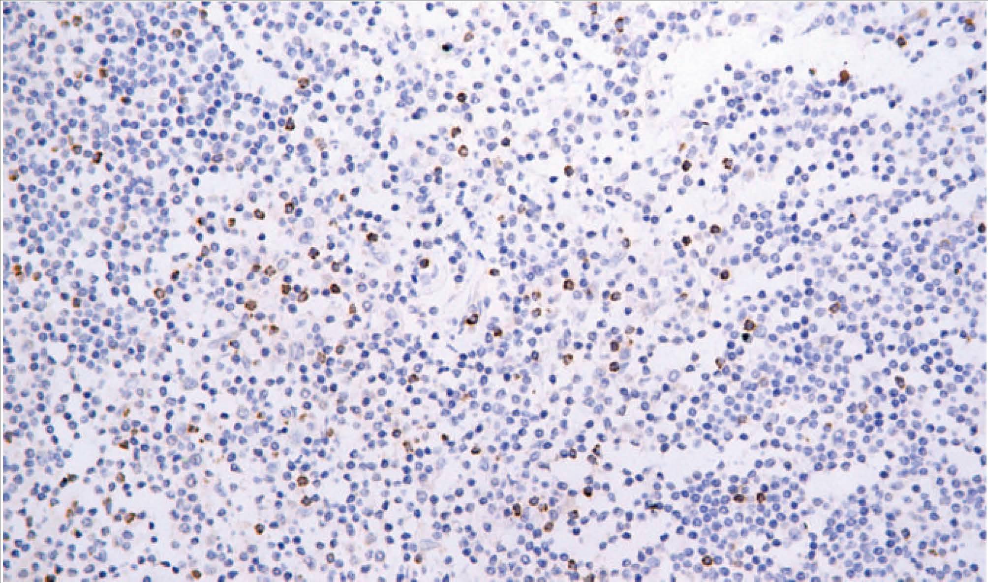 14 - TIA-1 AD80171